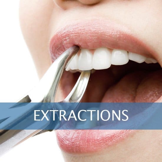 Exractions - Root Canals, Crown Lenghtening - Post Op Instructions - Framingham Dentists, Unique Dental of Framingham.