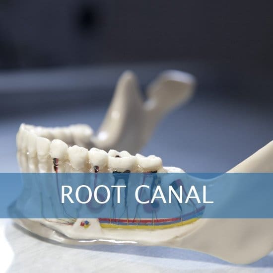 Root Canals, Crown Lenghtening - Post Op Instructions - Framingham Dentists, Unique Dental of Framingham.