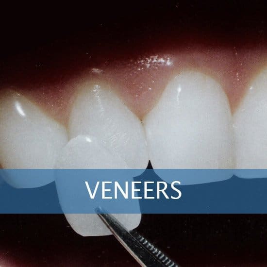Veneers - Dental Implants - Dentures - Exractions - Root Canals, Crown Lenghtening - Post Op Instructions - Framingham Dentists, Unique Dental of Framingham.