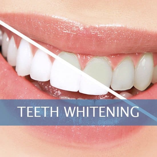 Teeth Whitening - Veneers - Dental Implants - Dentures - Exractions - Root Canals, Crown Lenghtening - Post Op Instructions - Framingham Dentists, Unique Dental of Framingham.